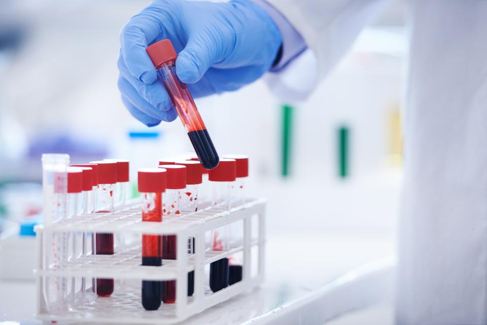 شظايا الحمض النووي.. اختبار دم ثوري في مواجهة السرطان